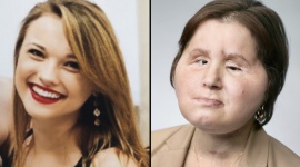 Zdrowie w pakiecie Zdrowie, LIFESTYLE - Świadomość na temat zdrowego trybu życia wzrasta. Ciągle jednak zdecydowanie za mało osób dba o profilaktykę, która jest nieodłącznym elementem zachowania prawidłowej kondycji organizmu.