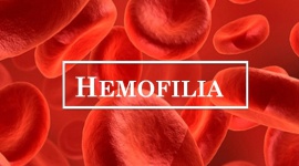 Hemofilia – co wiemy o tej chorobie? Zdrowie, LIFESTYLE - Odpowiedzi na pytanie o hemofilię, postawione podczas sondy ulicznej mogą zaskakiwać. Polacy nie mają dużej wiedzy na jej temat, chociaż jest to jedna z najczęstszych skaz krwotocznych i najwcześniej rozpoznawanych chorób genetycznych.
