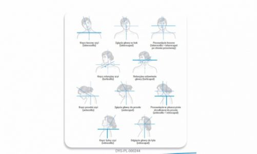 Dystonia – kiedy mimowolne ruchy ciała mogą zwiastować chorobę?